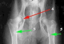 Важность правильного позиционирования при выполнении рентгеновских снимков тазобедренного сустава.