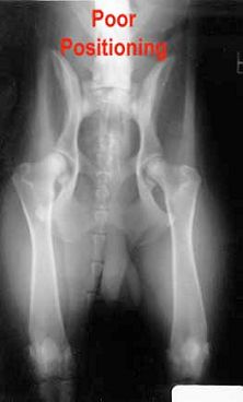 Важность правильного позиционирования при выполнении рентгеновских снимков тазобедренного сустава.