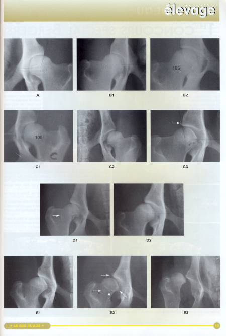 Рентгеновские снимки ненормального развития тазобедренной кости